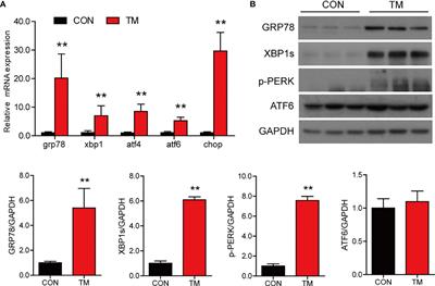 Endoplasmic Reticulum Stress Disturbs Lipid Homeostasis and Augments Inflammation in the Intestine and Isolated Intestinal Cells of Large Yellow Croaker (Larimichthys crocea)